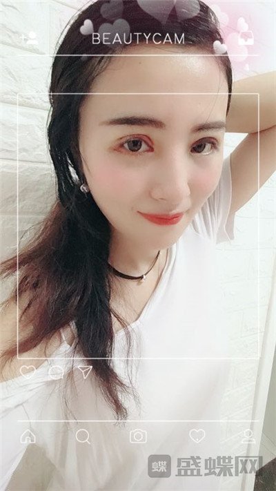 北京百达丽苏婷眼部手术案例价格分享,老阿姨变身小姐姐超开心~~