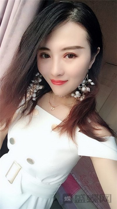 北京百达丽苏婷眼部手术案例价格分享,老阿姨变身小姐姐超开心~~