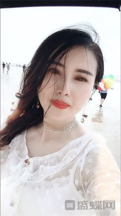 北京百达丽苏婷眼部手术案例价格分享,老阿姨变身小姐姐超开心~~
