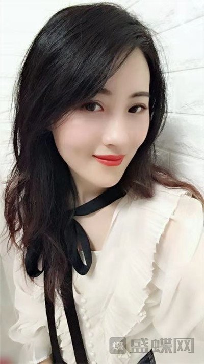 北京百达丽苏婷眼部手术案例价格分享,老阿姨变身小姐姐超开心~~