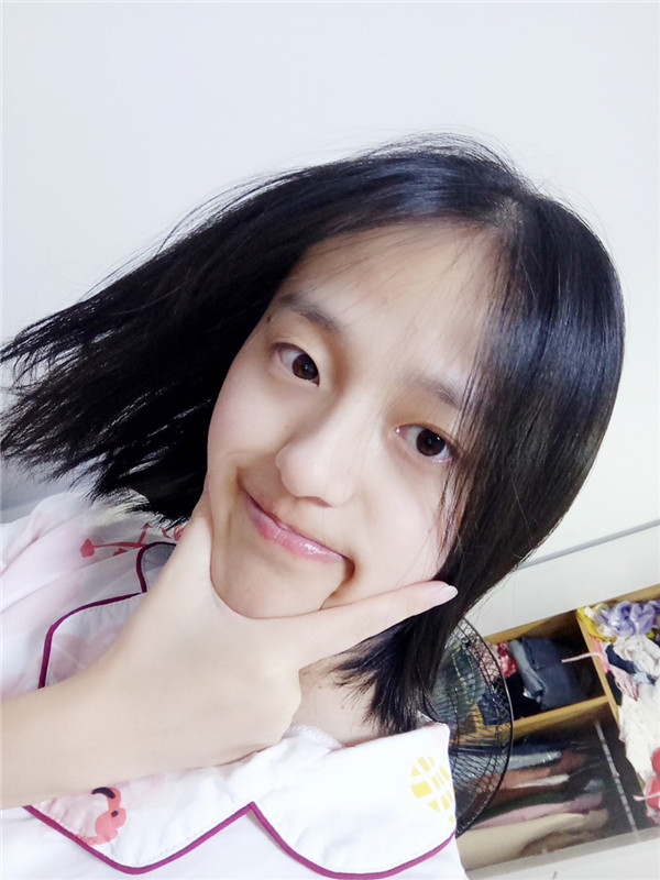 兰州亚韩武剑耳软骨复合隆鼻案例分享连载(一)