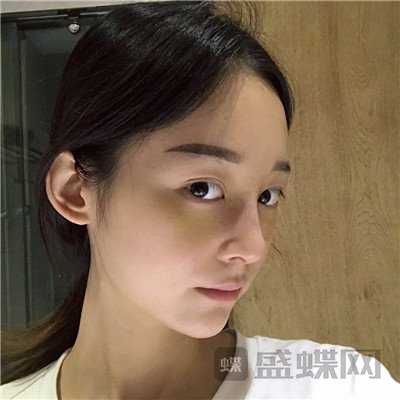 上海百达丽沈国雄隆鼻案例价格分享,较好看的鼻子没有之一~