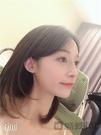 上海百达丽沈国雄隆鼻案例价格分享,较好看的鼻子没有之一~