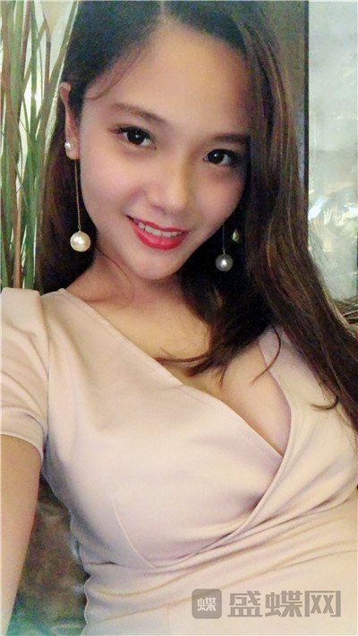 上海华美谢卫国假体隆胸案例价格分享,这么真实自然的胸我是第一次见到!