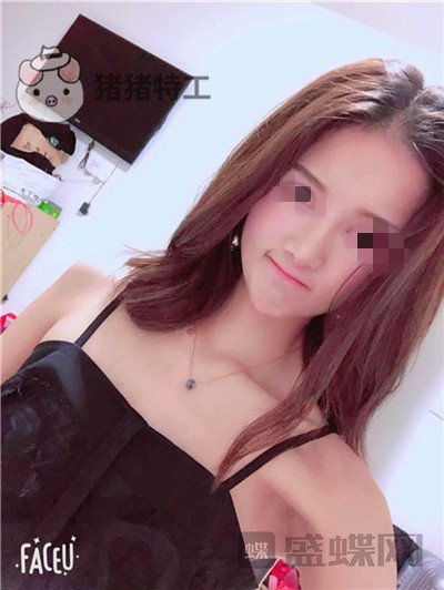 福州美贝尔原上海九院赵栋材面部填充案例价格分享,做完皮肤感觉在发光~~