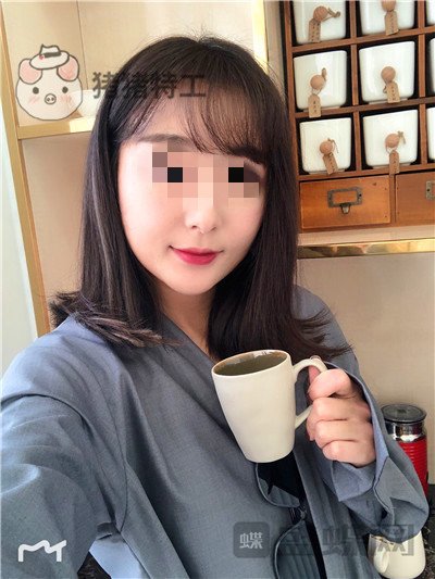 北京俊泰丽格薛志强埋线提升案例价格分享,脸瞬间就小了整整两圈有图有真相~!