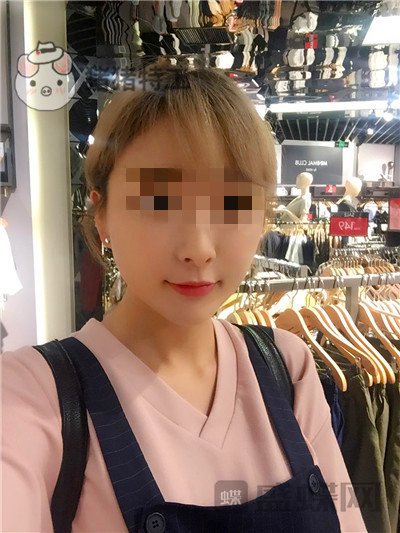 北京俊泰丽格薛志强埋线提升案例价格分享,脸瞬间就小了整整两圈有图有真相~!