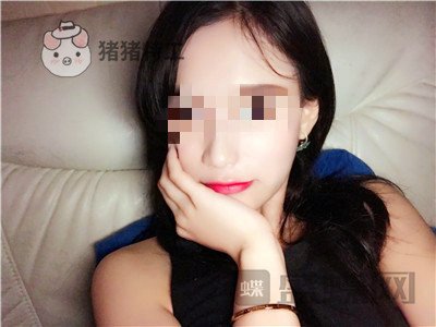 哈尔滨美联致美侯锋玉面部填充案例价格分享,现在我就像一个高中生~