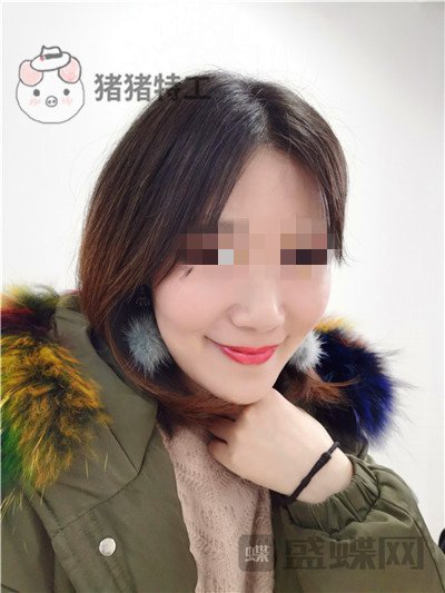 重庆华美陈凯面部填充案例价格分享,妈妈变成姐姐的惊奇改变!