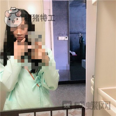长沙艺星秦晓东隆鼻案例价格分享,这个颜值可以当网红了!