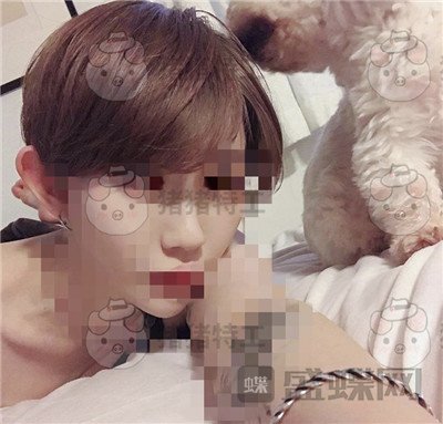 上海九院张盈帆鼻修复案例价格分享,平面模特小姐姐的鼻修复之路~