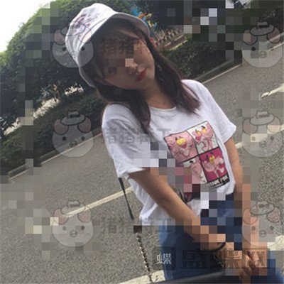 重庆万家燕王珍祥颧骨内推案例价格分享,瞬间变身十八岁美少女~