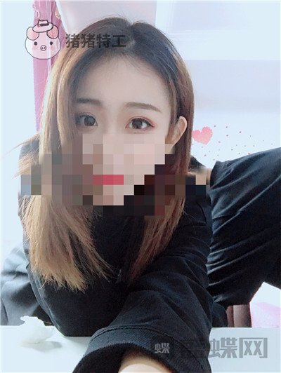 杭州美莱韩超双眼皮案例价格分享,做个双眼皮朋友以为我去换了个头??