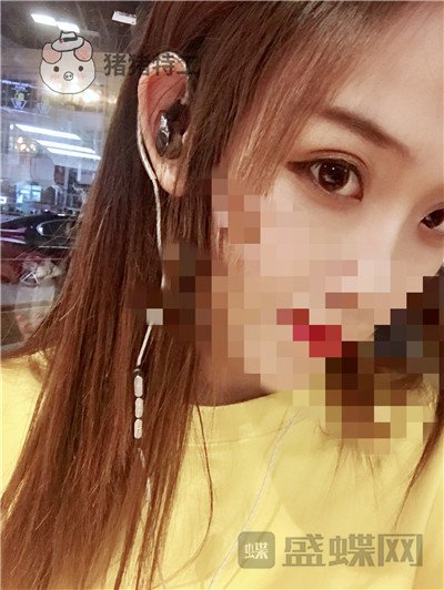 杭州美莱韩超双眼皮案例价格分享,做个双眼皮朋友以为我去换了个头??