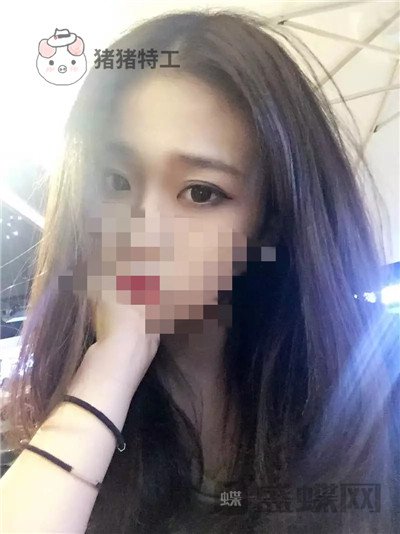 杭州美莱韩超双眼皮案例价格分享,做个双眼皮朋友以为我去换了个头??