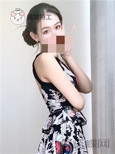 杭州美莱韩超双眼皮案例价格分享,做个双眼皮朋友以为我去换了个头??