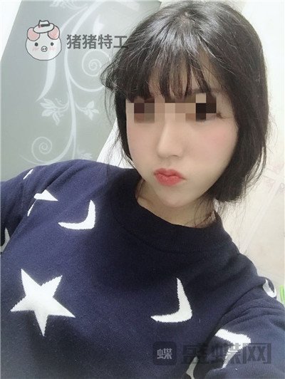 北京润美玉之光王明利面部填充案例价格分享,现在的脸让我自信心爆棚~