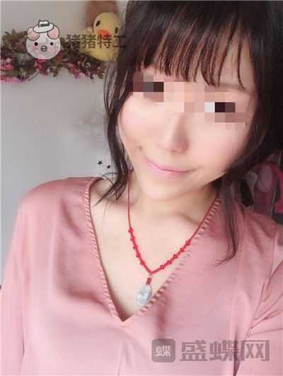 北京润美玉之光王明利面部填充案例价格分享,现在的脸让我自信心爆棚~