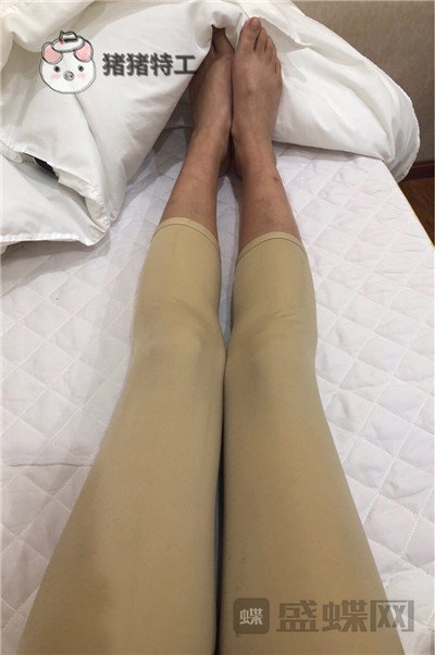 昆明梦想整形李成龙吸脂案例价格分享,小象腿到筷子腿的完美蜕变~
