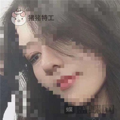 上海百达丽周珍艳双眼皮鼻部手术案例价格分享,我终于也变成了女神!