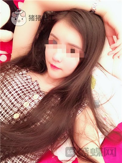 上海华美李健面部填充案例价格分享,开始脸肿的样子以为整失败了。
