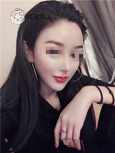 上海华美李庭勋隆鼻案例价格分享,这张混血脸你招架得住吗?