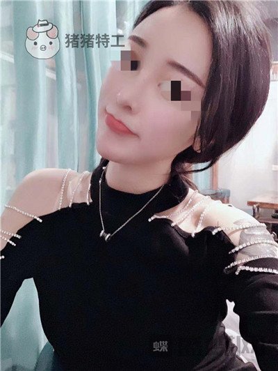 上海华美李庭勋隆鼻案例价格分享,这张混血脸你招架得住吗?