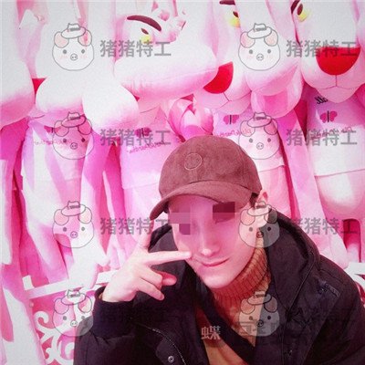 北京长虹于志宏鼻部手术案例价格分享,追求完美的男神现在如愿以偿。
