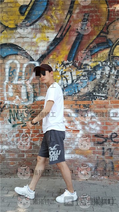 北京长虹于志宏鼻部手术案例价格分享,追求完美的男神现在如愿以偿。
