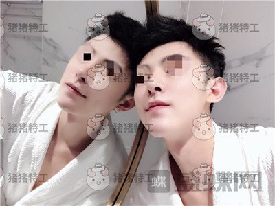 上海华美叶丽萍垫下巴案例价格分享,谁说只有女孩子尖尖下巴好看?