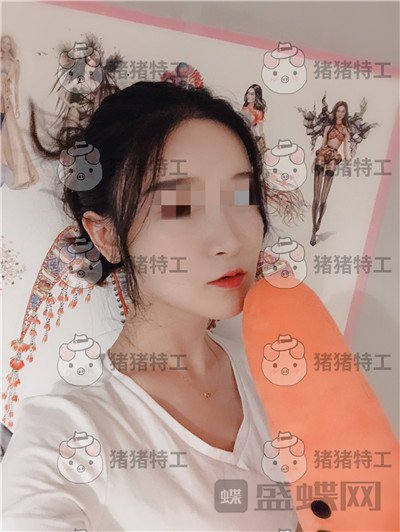 上海华美李志海下颌角整形案例价格分享,眼瞅着这张脸小了整整两圈。。