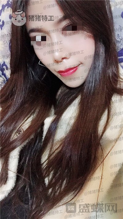 上海愉悦美联臣陈红梅脂肪填充案例价格分享,大家来帮我看看这是整形失败了吗?