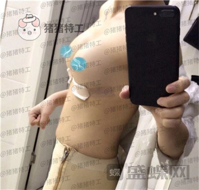 南京美贝尔黄名斗隆胸案例价格分享,感觉自己都备注自己诱惑到了~~