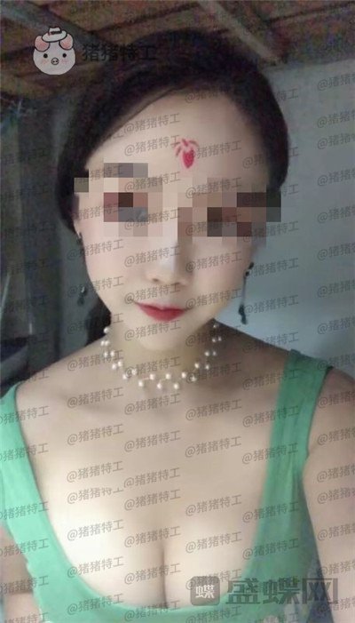 南京美贝尔黄名斗隆胸案例价格分享,感觉自己都备注自己诱惑到了~~