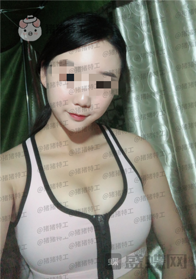 南京美贝尔黄名斗隆胸案例价格分享,感觉自己都备注自己诱惑到了~~