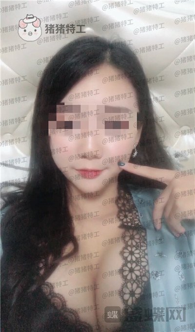 南京美贝尔黄名斗隆胸案例价格分享,感觉自己都备注自己诱惑到了~~