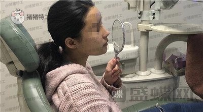 上海九院张盈帆隆鼻案例价格分享,仙女的鼻子是怎么养成的?