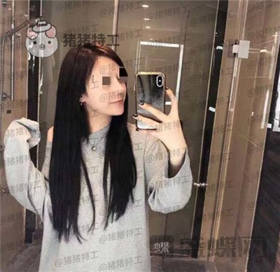 成都西区医院车红昌隆鼻案例价格分享,亲戚都说我鼻子高高的很好看~