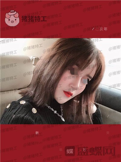 北京玲珑梵宫张燕雄隆鼻案例价格分享,货比三家找到的良心医院成果太完美了~
