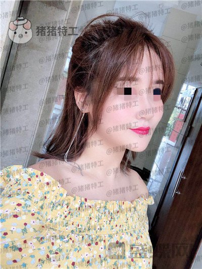 北京玲珑梵宫张燕雄隆鼻案例价格分享,货比三家找到的良心医院成果太完美了~