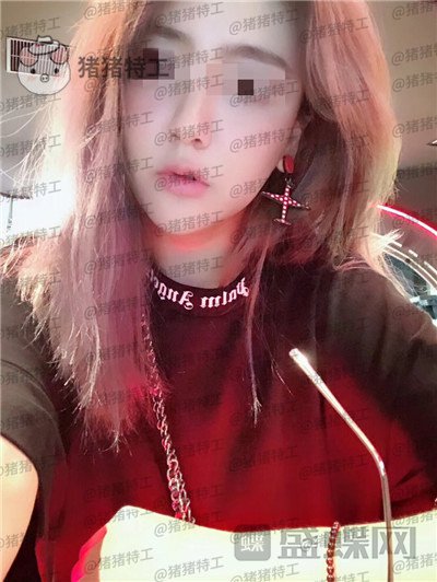 北京美莱宋延刚面部填充案例价格分享,直接年轻十五岁的果太惊艳了!