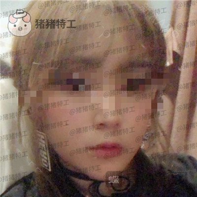 北京美莱宋延刚面部填充案例价格分享,直接年轻十五岁的果太惊艳了!