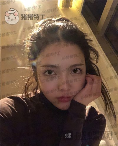 重庆华美潘宝华颧骨整形案例价格分享,神仙颜值先鬼后人的蜕变。