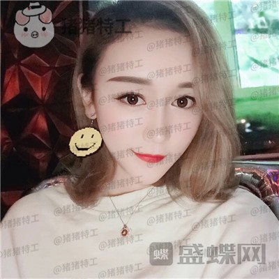 贵阳华美黄在弘面部填充案例价格分享,做这么多项目的果大家觉得好看吗?