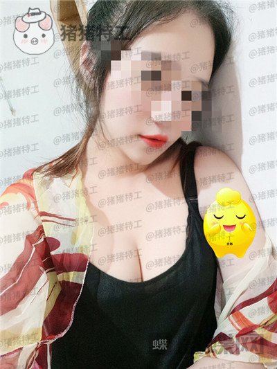 北京京韩王沛森隆胸案例价格分享,腰都变得细了我也拥有了S型曲线。
