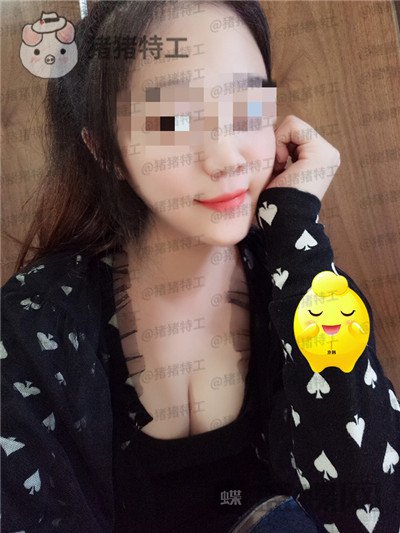 北京京韩王沛森隆胸案例价格分享,腰都变得细了我也拥有了S型曲线。