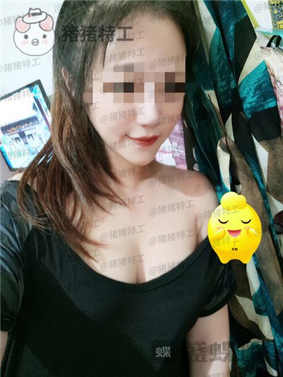 北京京韩王沛森隆胸案例价格分享,腰都变得细了我也拥有了S型曲线。