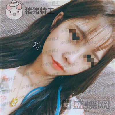成都西区医院车红昌隆鼻案例价格分享,做完变仙女自拍前置像头都很好看~