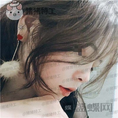 成都西区医院车红昌隆鼻案例价格分享,做完变仙女自拍前置像头都很好看~