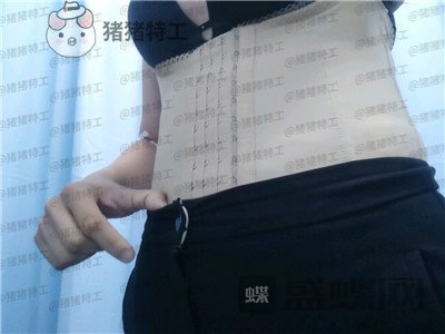 上海九院濮哲铭吸脂案例价格分享,做完果不是很明X请问是失败了吗?